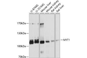 Western blot analysis of extracts of various cell lines, using MYT1 antibody (ABIN6129057, ABIN6144304, ABIN6144305 and ABIN6215004) at 1:1000 dilution.