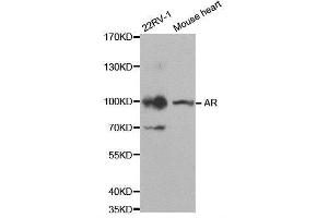 Western blot analysis of extracts of various cell lines, using AR antibody. (Androgen Receptor anticorps)