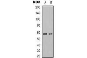 Western blot analysis of Pyruvate Kinase expression in MCF7 (A), HepG2 (B) whole cell lysates. (Pyruvate Kinase anticorps)