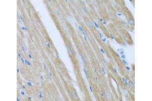 Immunohistochemistry of paraffin-embedded Mouse heart using CCM2 Polyclonal Antibody at dilution of 1:100 (40x lens). (CCM2 anticorps)