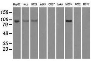 Image no. 3 for anti-Hexokinase 2 (HK2) antibody (ABIN1498647) (Hexokinase 2 anticorps)