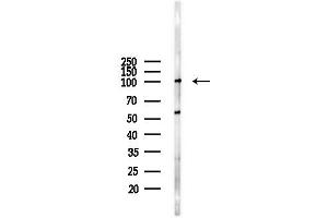 Western blot analysis of lysates from  cells(starvation,24h treatment), using TELO2 Antibody at 1/1000 dilution.