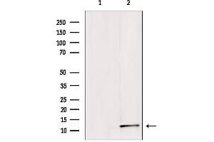 Western blot analysis of extracts from HepG2, using Sumo1 Antibody. (SUMO1 anticorps  (N-Term))