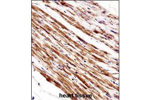 Immunohistochemistry (Formalin/PFA-fixed paraffin-embedded sections) of human heart tissue with PLA2G5 polyclonal antibody  followed by peroxidase conjugation of the secondary antibody and DAB staining.