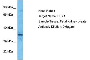 Host: Rabbit Target Name: HEY1 Sample Type: Fetal Kidney lysates Antibody Dilution: 0. (HEY1 anticorps  (N-Term))