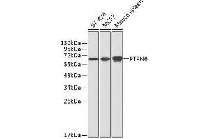 Western blot analysis of extracts of various cell lines using PTPN6 Polyclonal Antibody at dilution of 1:1000. (SHP1 anticorps)