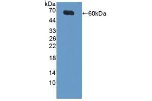 Detection of Recombinant XIAP, Human using Polyclonal Antibody to X-linked Inhibitor Of Apoptosis Protein (XIAP)