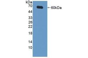 Detection of Recombinant XIAP, Human using Polyclonal Antibody to X-linked Inhibitor Of Apoptosis Protein (XIAP) (XIAP anticorps  (AA 1-497))