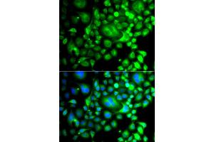 Immunofluorescence analysis of A549 cells using SNX3 antibody (ABIN6290935). (Sorting Nexin 3 anticorps)