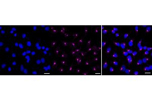 anti-Glucose-6-Phosphate Isomerase (GPI) antibody