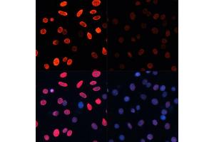 Immunofluorescence analysis of C6 cells using Acetyl-Histone H3-K18 antibody (ABIN7267668) at dilution of 1:100.