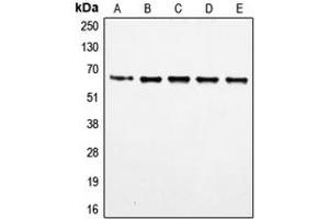 Western blot analysis of FOXO4 (pS197) expression in HeLa (A), MM142 (B), HuT78 (C), HEK293T (D), NIH3T3 (E) whole cell lysates.