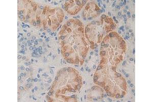 IHC-P analysis of kidney tissue, with DAB staining. (PLTP anticorps  (AA 337-479))
