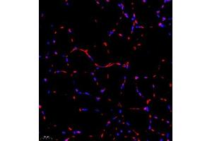 Immunofluorescence of paraffin embedded mouse Skeletal muscle using RB1 (ABIN7075477) at dilution of 1:1400 (400x lens)