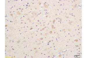Formalin-fixed and paraffin embedded rat brain labeled with Anti phospho-B-Raf (Ser365) Polyclonal Antibody, Unconjugated (ABIN682888) at 1:200 followed by conjugation to the secondary antibody and DAB staining (SNRPE anticorps  (pSer365))