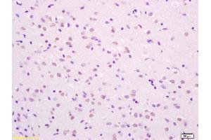 Formalin-fixed and paraffin embedded rat brain labeled with Rabbit Anti phospho-SHC(Ser36) Polyclonal Antibody, Unconjugated (ABIN745913) at 1:200 followed by conjugation to the secondary antibody and DAB staining (SHC1 anticorps  (pSer36))