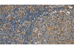 Immunohistochemistry of paraffin-embedded Human tonsil using CLIC1 Polyclonal Antibody at dilution of 1:30