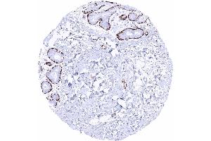 Breast Caldesmon h staining of myoepithelial cells Caldesmon h immunohistochemistry (Recombinant Caldesmon anticorps)