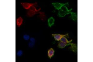 ABIN6260492 and ABIN6268884 staining HepG2 by IF/ICC. (CTNNA1 anticorps  (C-Term))