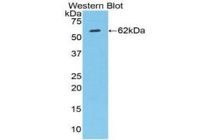 Western Blotting (WB) image for anti-Hypoxia Inducible Factor 1, alpha Subunit (Basic Helix-Loop-Helix Transcription Factor) (HIF1A) (AA 220-349) antibody (ABIN1859153)