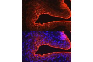 Immunofluorescence analysis of rat bladder using UPK3A Rabbit pAb (ABIN6128904, ABIN6149950, ABIN6149951 and ABIN6214142) at dilution of 1:100 (40x lens). (Uroplakin 3A anticorps  (AA 19-207))