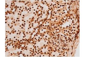 ABIN6267604 at 1/200 staining Mouse kidney tissue sections by IHC-P.