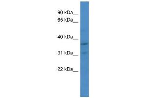 WB Suggested Anti-CDK2 Antibody Titration: 1. (CDK2 anticorps  (Middle Region))