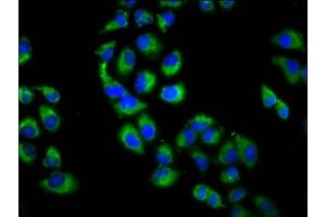 Immunofluorescence staining of Hela cells with ABIN7151301 at 1:200, counter-stained with DAPI. (Zinc Finger Protein 650 (ZNF650) (AA 960-1113) anticorps)