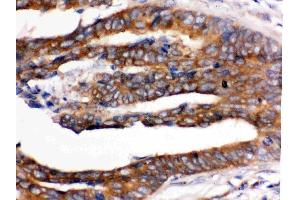 IHC analysis of RENT1/hUPF1 using anti-RENT1/hUPF1 antibody (ABIN3043955).