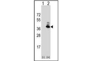 Image no. 5 for anti-Aspartoacylase (ASPA) (AA 89-118), (N-Term) antibody (ABIN452768) (ASPA anticorps  (N-Term))