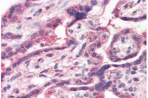 Human Placenta (formalin-fixed, paraffin-embedded) stained with TFF2 antibody ABIN351426 at 15 ug/ml followed by biotinylated goat anti-rabbit IgG secondary antibody ABIN481713, alkaline phosphatase-streptavidin and chromogen. (Trefoil Factor 2 anticorps  (Internal Region))
