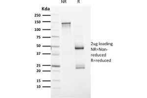 Purified PAX8 Mouse Monoclonal Antibody (PAX8/1491).