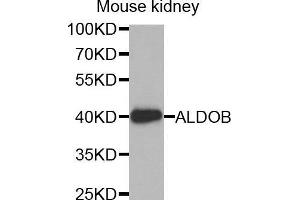 Western Blotting (WB) image for anti-Aldolase B, Fructose-Bisphosphate (ALDOB) (AA 1-200) antibody (ABIN1678634) (ALDOB anticorps  (AA 1-200))