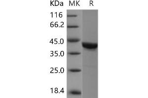 Western Blotting (WB) image for Casein Kinase 2 alpha 1 (CSNK2A1) protein (ABIN7320134) (CSNK2A1/CK II alpha Protéine)
