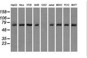 Western blot analysis of extracts (35 µg) from 9 different cell lines by using anti-LTA4H monoclonal antibody. (LTA4H anticorps)