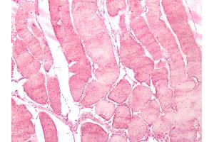 Human Skeletal Muscle: Formalin-Fixed, Paraffin-Embedded (FFPE) (NMUR2 anticorps  (N-Term))