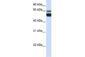 SMPD1 antibody used at 1 ug/ml to detect target protein. (SMPD1 anticorps  (Middle Region))