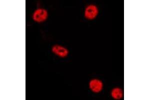 ABIN6275549 staining HepG2 by IF/ICC. (PPP2R3B anticorps  (Internal Region))
