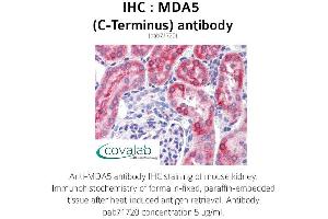 Image no. 2 for anti-Interferon Induced with Helicase C Domain 1 (IFIH1) antibody (ABIN1736854) (IFIH1 anticorps)
