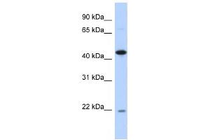 Western Blotting (WB) image for anti-RNA-Binding Protein NOB1 (NOB1) antibody (ABIN2459838) (NOB1 anticorps)