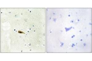 Immunohistochemistry analysis of paraffin-embedded human brain tissue, using MYST1 Antibody. (MYST1 anticorps  (AA 101-150))