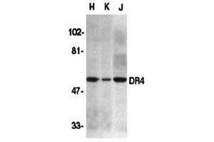 Western Blotting (WB) image for anti-Drought-Repressed 4 Protein (DR4) (N-Term) antibody (ABIN1031359)
