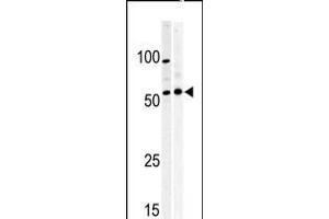 Western blot analysis of anti-PKMYT1 Pabin A375(left) and Y79 (right)cell line lysate. (MYT1 anticorps  (C-Term))