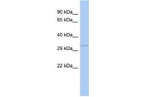 GNB1 antibody used at 1 ug/ml to detect target protein. (GNB1 anticorps)