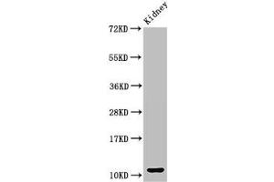 Western Blot Positive WB detected in: Mouse kidney tissue All lanes: CCL3 antibody at 3 μg/mL Secondary Goat polyclonal to rabbit IgG at 1/50000 dilution Predicted band size: 11 kDa Observed band size: 11 kDa
