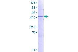 Image no. 1 for FK506 Binding Protein 11, 19 KDa (FKBP11) (AA 1-201) protein (GST tag) (ABIN1354112)