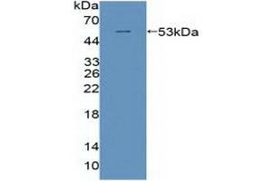Detection of Recombinant POLd, Human using Polyclonal Antibody to Polymerase DNA Directed Delta 1 (POLd)