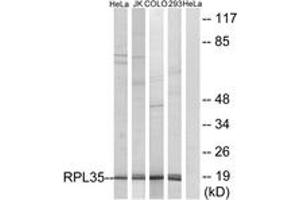 Western blot analysis of extracts from 293/HeLa/COLO/Jurkat cells, using RPL35 Antibody. (RPL35 anticorps  (AA 51-100))