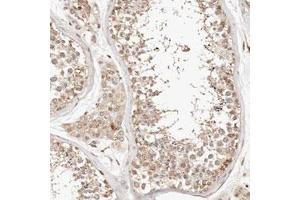 Immunohistochemical staining (Formalin-fixed paraffin-embedded sections) of human testis with KIF9 polyclonal antibody  shows moderate cytoplasmic positivity in cells in seminiferous ducts and Leydig cells. (KIF9 anticorps)