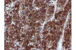 Image no. 1 for anti-Sepiapterin Reductase (SPR) antibody (ABIN1501115)